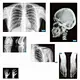x ray toy