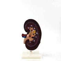 Human kidney model