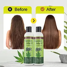 Itchy Scalp Shampoo